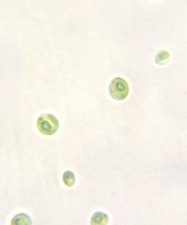 Picture of chlorella sorokiana algae.