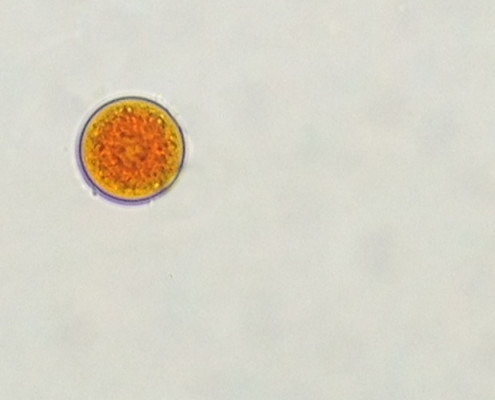 Picture of Haematococcus Pluvialis (AE9) with red astaxanthin.
