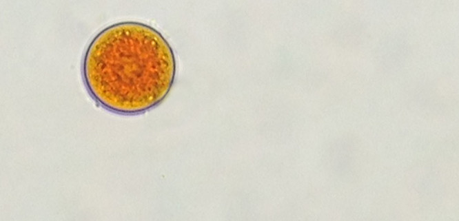 Picture of Haematococcus Pluvialis (AE9) with red astaxanthin.