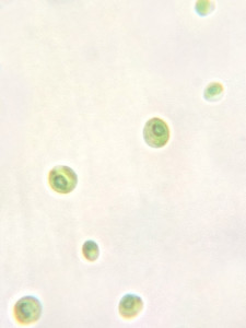 Chlorella Sorokiniana