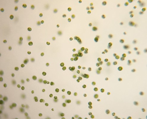 Picture of Haematococcus pluvalis.