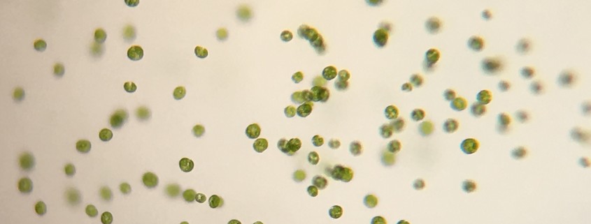 Picture of Haematococcus pluvalis.