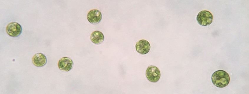 Microscopic picture of Haematococcus in motile phase.
