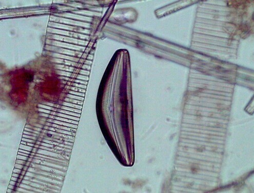 Picture taken with a microscope of diatoms glass shell called frustules.