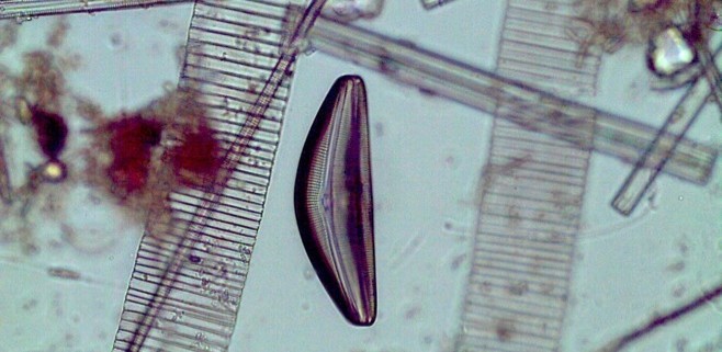 Picture taken with a microscope of diatoms glass shell called frustules.