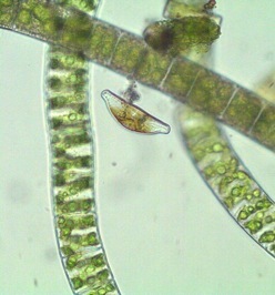 Picture taken with a microscope showing a green Spirugyra algae and a brown Diatom algae.