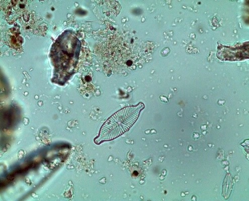 Picture taken with a microscope of the glass shell called a frustule of diatoms.